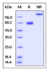 Human PD-L1, Mouse IgG1 Fc Tag, low endotoxin (HPLC-verified) on SDS-PAGE under reducing (R) and non-reducing (NR) conditions. The gel was stained overnight with Coomassie Blue. The purity of the protein is greater than 92%.